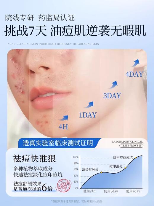 【痘肌专研 祛痘平坑】透真 寡肽多效舒缓冻干粉（3ml+80mg)x4对#寡肽冻干粉祛痘精华液女修复祛痘痘淡化痘印痘坑痘疤闭口粉刺正品 商品图3