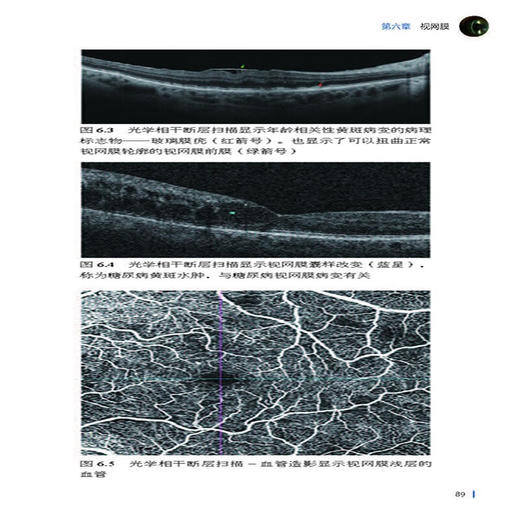 眼科入门精要图解 张波洲 张贵森 主译 青光眼 白内障 黄斑变性 斜视 甲状腺眼病 眼科实习 医学 北京科学技术出版社9787571441357 商品图3