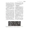 立体定向手术联合放射外科治疗颅内肿瘤 立体定向活检联合放射外科治疗颅内肿瘤 编张剑宁孙君昭 北京大学医学出版社9787565932069 商品缩略图4