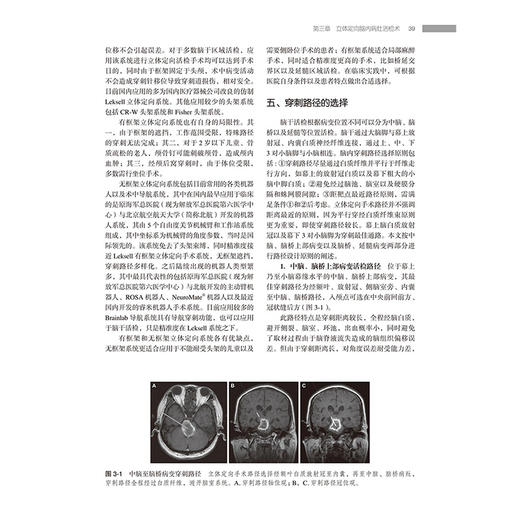 立体定向手术联合放射外科治疗颅内肿瘤 立体定向活检联合放射外科治疗颅内肿瘤 编张剑宁孙君昭 北京大学医学出版社9787565932069 商品图4