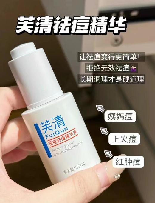 芙清祛痘精华 30ml 控油保湿淡化痘印改善泛红修护 无酸清痘舒缓精华液 商品图1