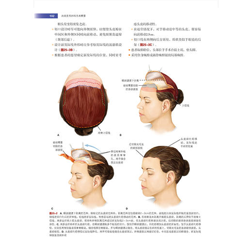 整形外科手术精要Ⅰ面部美容外科手术精要 卜面部填充物注射技术 面部磨削术 龙笑 陶凯等主译 辽宁科学技术出版社9787559135223 商品图4