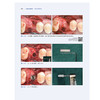 生物导向骨增量骨柱与骨片技术 配视频 常晓龙 骨柱与骨片技术的理论基础病例生物学口腔种植学辽宁科学技术出版社9787559135599  商品缩略图4