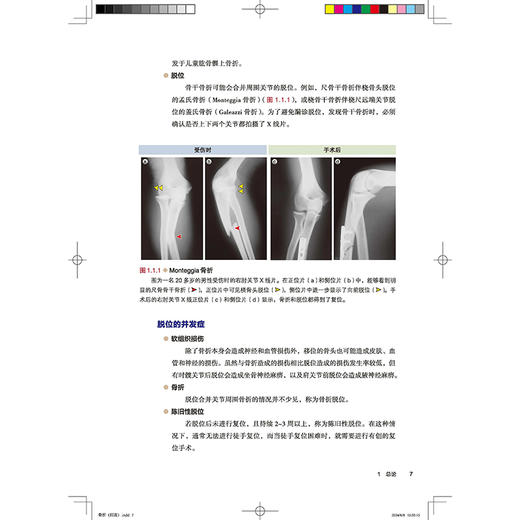 骨折 脱位 损伤 影像诊断及治疗图解 详细分型 视频演示 骨肌影像诊断技巧丛书 韩冰 朗宁主译北京科学技术出版社9787571432171 商品图3