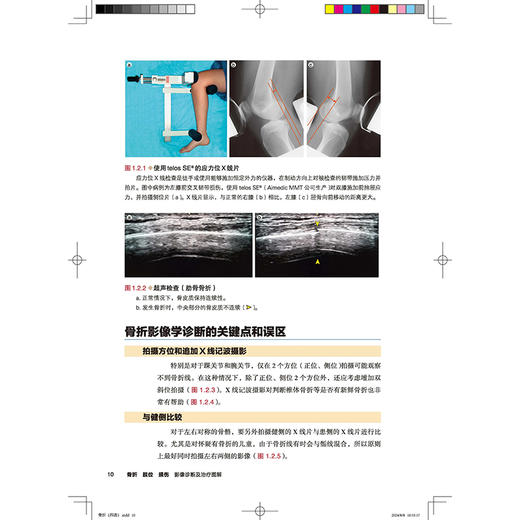 骨折 脱位 损伤 影像诊断及治疗图解 详细分型 视频演示 骨肌影像诊断技巧丛书 韩冰 朗宁主译北京科学技术出版社9787571432171 商品图4