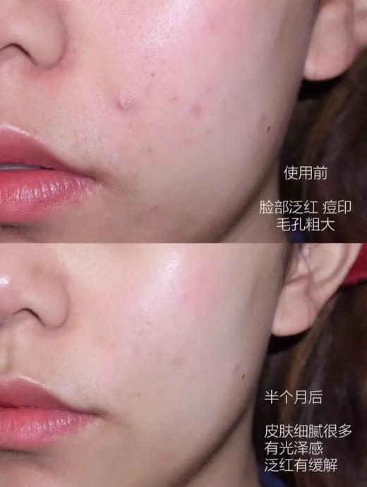 【9.22王炸割肉价】黛珂沁活晶澈洁面啫喱150g*2（限25年7月） 商品图4