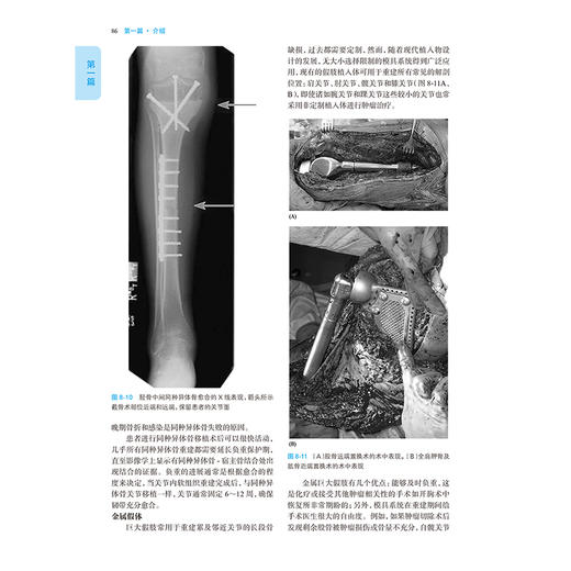 癌症康复 原理与实践 第2版 主译席家宁 恽晓萍等 恶性疾病的评估与治疗 肿瘤的临床并发症 癌症疼痛 人民卫生出版社9787117362535 商品图4