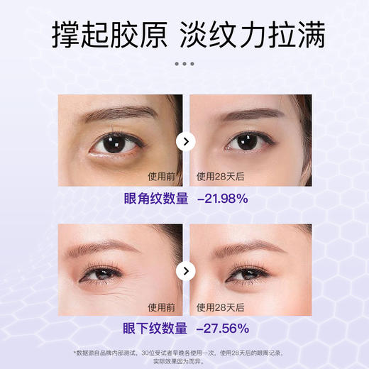 FVE玻色因紧致淡纹恒采眼霜【20g】 商品图1