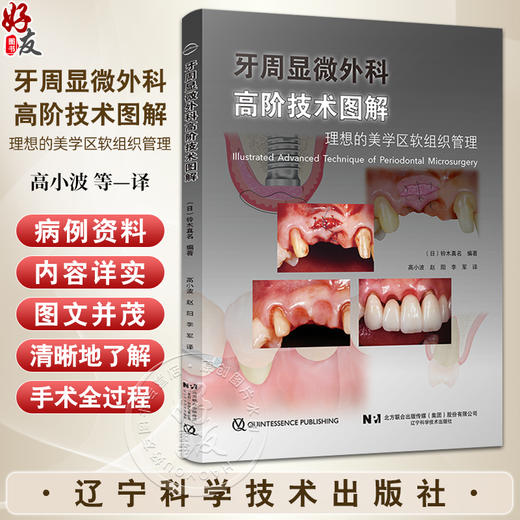 牙周显微外科高阶技术图解 理想的美学区软组织管理 铃木真名 高小波 赵阳 李军 译 牙周病口腔外辽宁科学技术出版社9787559136244 商品图0