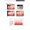 牙周显微外科高阶技术图解 理想的美学区软组织管理 铃木真名 高小波 赵阳 李军 译 牙周病口腔外辽宁科学技术出版社9787559136244 商品缩略图3