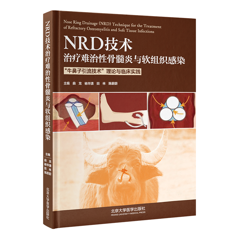 NRD技术治疗难治性骨髓炎与软组织感染  主编  曲龙 北医出版