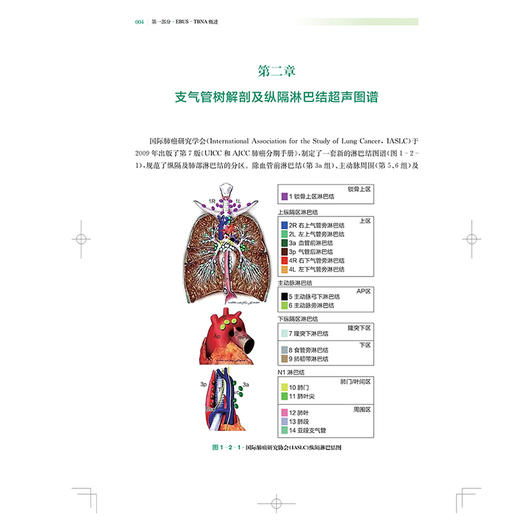 EBUS-TBNA技术及经典案例 超声内镜引导下经支气管针吸活检术  李时悦主编 上海科学技术出版社9787547867853 商品图4