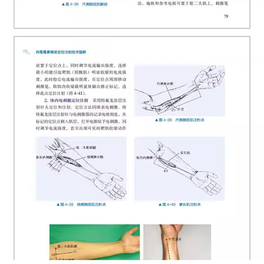 肉毒毒素精准定位注射技术图解 主编窦祖林 姜丽 温红梅 痉挛与肌张力障碍的干预策略 肉毒毒素 中国科学技术出版社9787523608210 商品图4