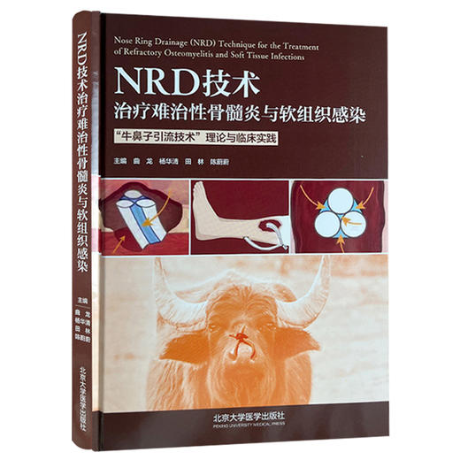 NRD技术治疗难治性骨髓炎与软组织感染 牛鼻子引流技术  理论与临床实践 主编曲龙 杨华清 田林等北京大学医学出版社9787565932243 商品图1