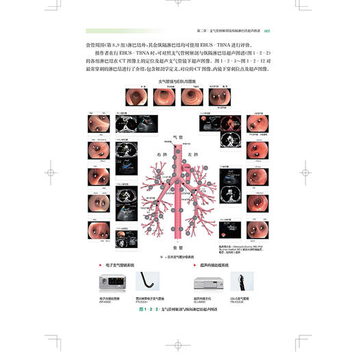 EBUS-TBNA技术及经典案例 超声内镜引导下经支气管针吸活检术  李时悦主编 上海科学技术出版社9787547867853 商品图3