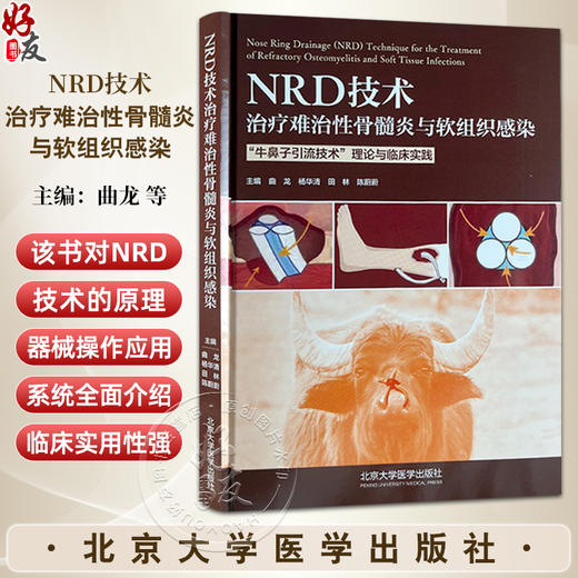 NRD技术治疗难治性骨髓炎与软组织感染 牛鼻子引流技术  理论与临床实践 主编曲龙 杨华清 田林等北京大学医学出版社9787565932243 商品图0