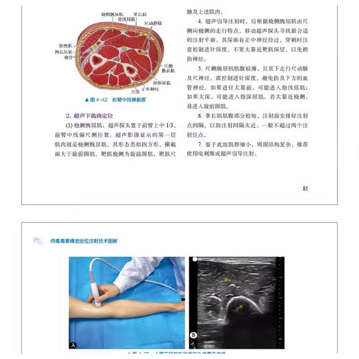 肉毒毒素精准定位注射技术图解 主编窦祖林 姜丽 温红梅 痉挛与肌张力障碍的干预策略 肉毒毒素 中国科学技术出版社9787523608210 商品图3