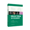 EBUS-TBNA技术及经典案例 超声内镜引导下经支气管针吸活检术  李时悦主编 上海科学技术出版社9787547867853 商品缩略图1