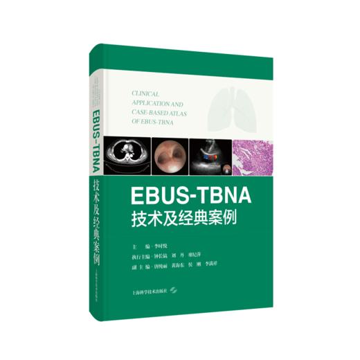 EBUS-TBNA技术及经典案例 超声内镜引导下经支气管针吸活检术  李时悦主编 上海科学技术出版社9787547867853 商品图1