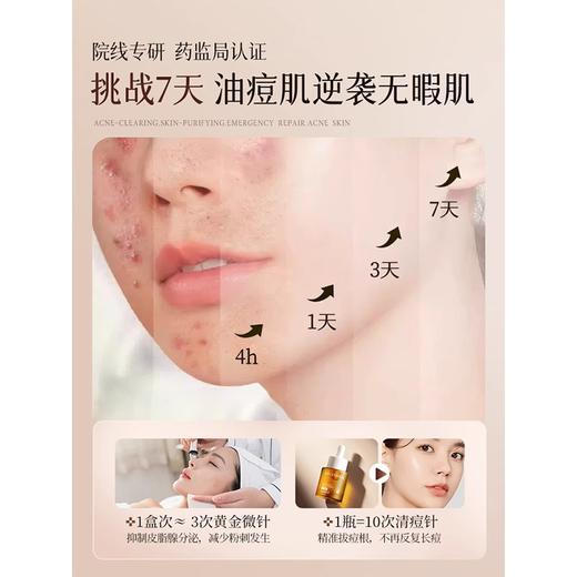 【祛痘不留印】水杨酸祛痘精华液35ml#水杨酸祛痘精华液祛痘印修复淡化痘疤控油去闭口粉刺黑头收缩毛孔 商品图2