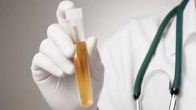 肾好不好，喝水就知道！喝水后有6个表现，不是大病就是癌！太多人以为只是水喝多了