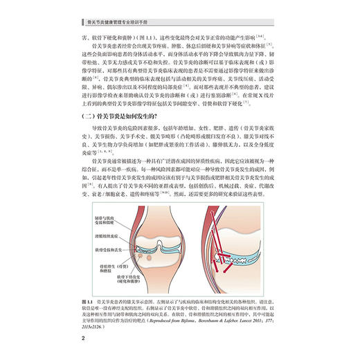 骨关节炎健康管理专业培训手册 骨关节炎的发病机制和流行病学 病史采集与体格检查 主译倪国新 北京大学医学出版社9787565931352 商品图3