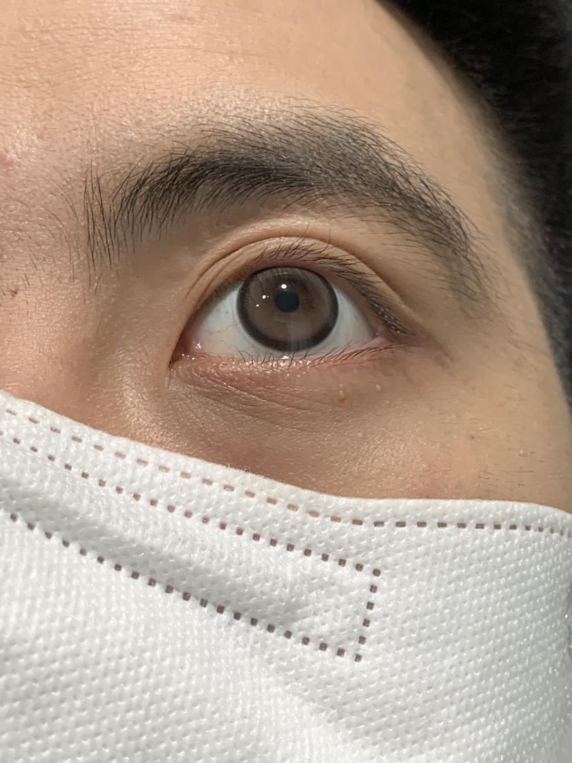 新品 牛乳色狗狗眼 14.5mm（着色13.9）0-800°·医用硅水