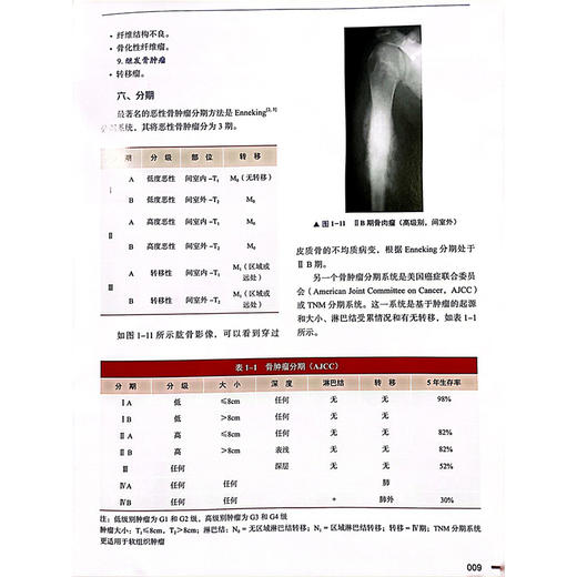 骨肿瘤诊断与治疗 主译高嵩涛 牛科润 成骨性骨肿瘤 成软骨性骨肿瘤 血管来源骨肿瘤 尤因肉瘤 中国科学技术出版社9787523607190 商品图4