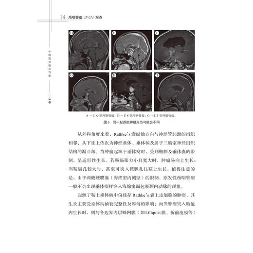 颅咽管瘤2024观点 主编 漆松涛 刘忆 颅咽管瘤命名的演变及分类 神经病学与精神病学 医学书籍 科学技术文献出版社9787523517192 商品图3