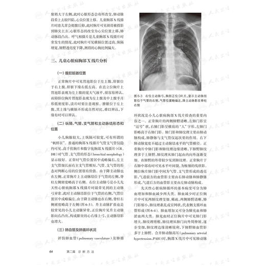 小儿心脏病学 第5版 第五版主编陈树宝 孙锟 黄国英 儿童心脏病遗传学检测 胎儿及新生儿时期心脏病 人民卫生出版社9787117364348 商品图3