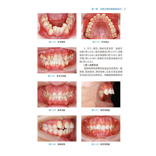 口腔正畸护理技术 口腔正畸临床常用材料及器械 口腔正畸常用护理技术 口腔正畸专科护理技术 黄慧萍人民卫生出版社9787117365147 商品图4