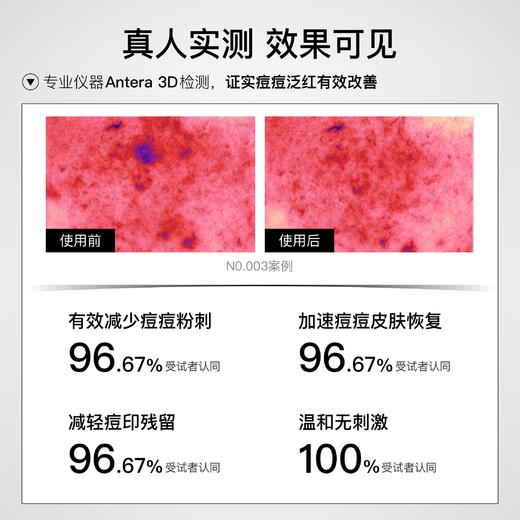 LAKELAB黑茶祛痘凝胶 祛痘精华 双核战痘，四类痘型全改善 商品图3