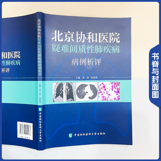 北京协和医院疑难间质性肺疾病病例析评 黄慧 陈茹萱 著 所涉及的间质性肺疾病的诊断 中国协和医科大学出版社9787567924567 商品图2