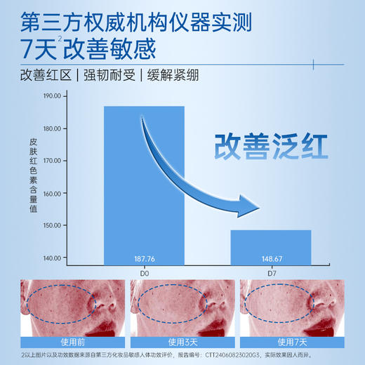 【买3送1】复因FOY舒敏保湿精华水60ml/120ml  敏感肌保湿补水舒缓 ***2件9折、3件8折 商品图4