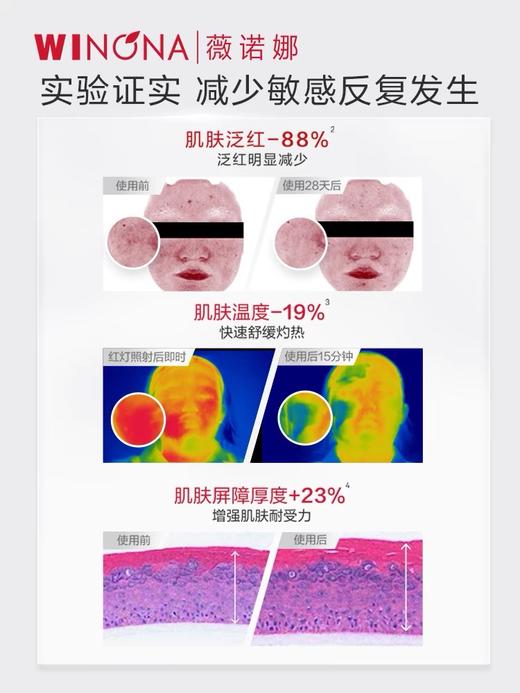 薇诺娜第二代舒敏保湿特护霜50ml  敏感肌面霜舒敏保湿补水修护 商品图6