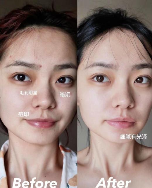 欧Y莱小黑瓶 税仓新到 商品图6