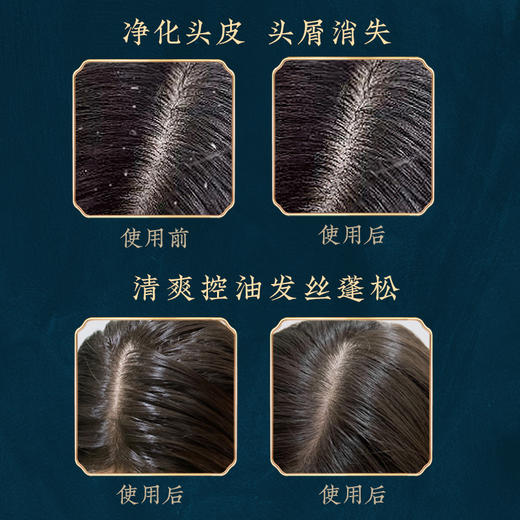 【星品钜惠】【拍一发二】敷本道和时尚防脱洗发露300ml 商品图2