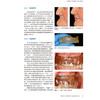 牙种植学的SAC分类 第2版 第二版 宿玉成 主译 种植 口腔医生iti修复牙医教科书 辽宁科学技术出版社9787559134196  商品缩略图4