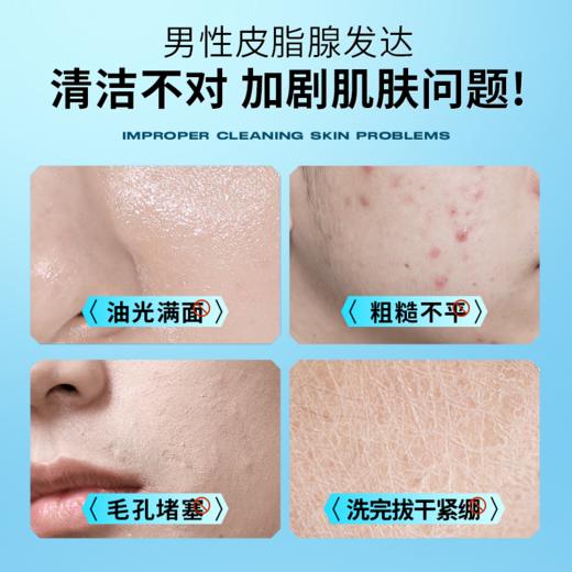 🔥【59元任选2件】左颜右色微酸洁面乳150g 洁净控油祛痘去黑头水润不紧绷 商品图2