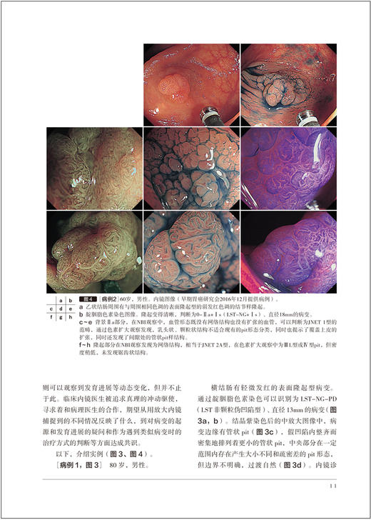 胃与肠 内镜医生也应该了解的下消化道肿瘤病理诊断标准 胃与肠翻译委员会译 消化内科 内镜检查 辽宁科学技术出版社9787559129772 商品图4