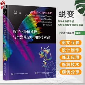 蜕变 数字化种植导板与全瓷修复中的医技实践 余涛等编 全牙列种植固定修复的基本流程与技术要点辽宁科学技术出版社9787559136305