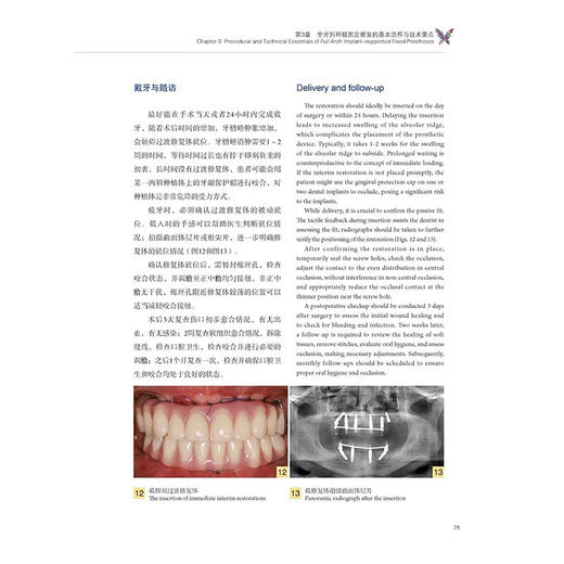 蜕变 数字化种植导板与全瓷修复中的医技实践 余涛等编 全牙列种植固定修复的基本流程与技术要点辽宁科学技术出版社9787559136305 商品图4