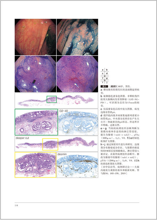 胃与肠 内镜医生也应该了解的下消化道肿瘤病理诊断标准 胃与肠翻译委员会译 消化内科 内镜检查 辽宁科学技术出版社9787559129772 商品图3