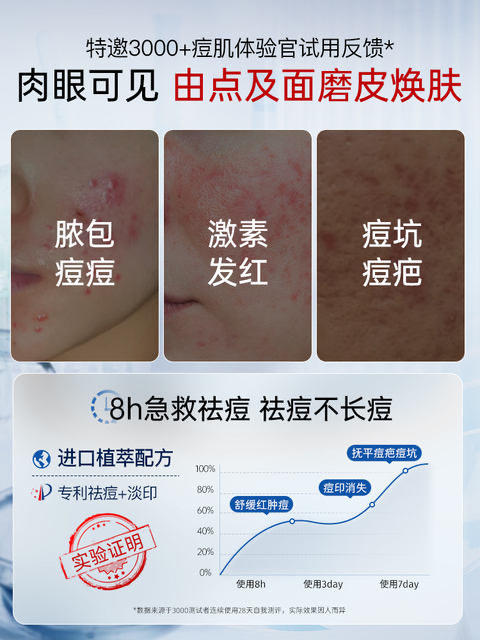 ORGINESE祛痘印修复淡化痘印祛痘膏痘坑男生女痘消闭口炎粉刺克星面霜50g 商品图1