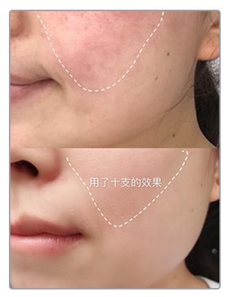 【清仓好价】德国Hermuna赫梦娜玻尿酸安瓶精华1ml*10支（效期至25.10-26年初） 商品图1