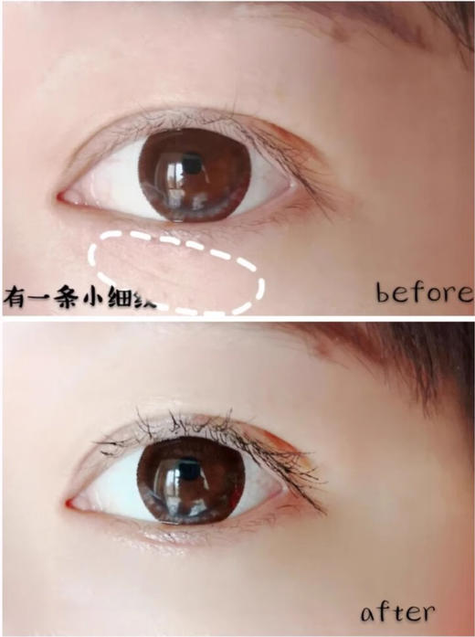 【10.6王炸割肉价】资生堂盼丽风姿智感抚痕眼霜15ml 商品图2