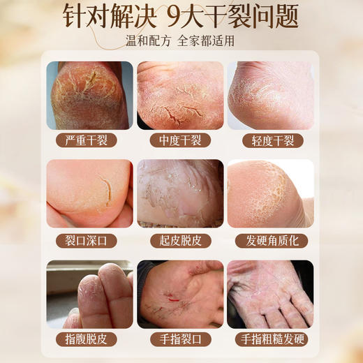 马油膏脚后跟干裂修复霜防裂补水保湿护手霜林足脱皮皴裂滋润凡士|儒意官方商城 商品图2