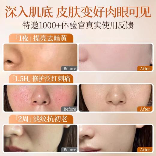 【美白不反黑】美白淡斑精华水120ml/雪肌美白精华乳100ml/美白无暇祛斑霜50g#377水乳套装正品美白提亮去黄保湿补水男女化妆护肤品官方旗舰店 商品图3