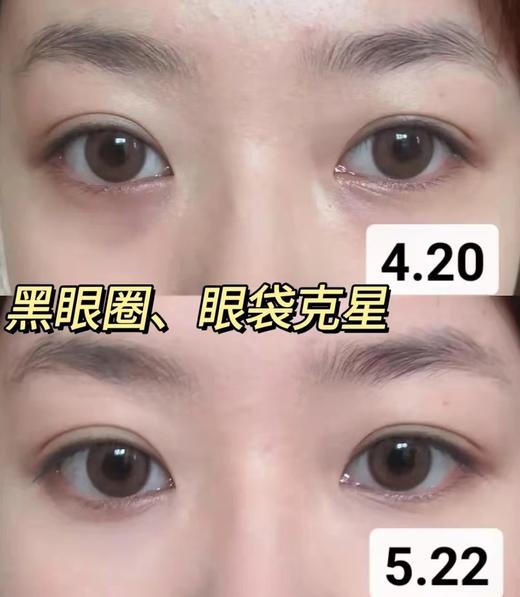 香P丽SHANGPREE红公主/绿公主淡化黑眼圈眼膜 商品图14