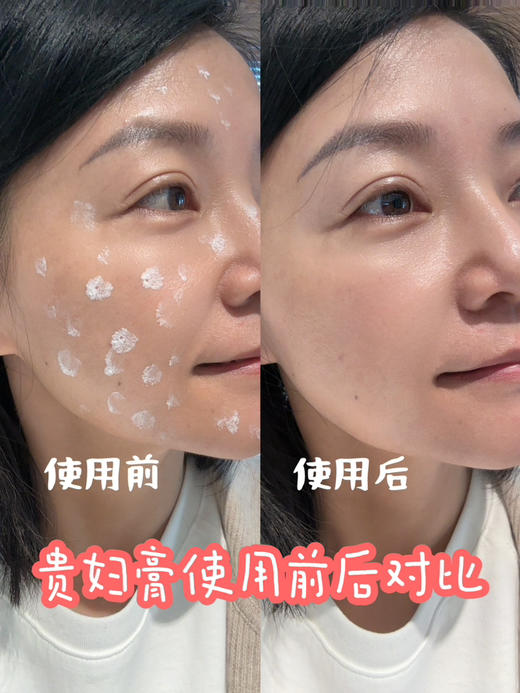 【💃女神节！】《订制高奢人参珍珠玻色因贵妇膏》加送体验装、洁面膏、保湿霜，精油调香 活性成分+芳疗愈疗发挥复配增效 无色素/无香精/无矿物油/无需卸妆，均匀肤色 隐藏毛孔 高奢成分/素颜/美颜/养肤 商品图1